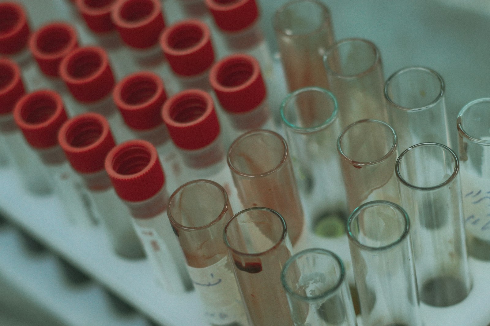 Theranos and the $9 Billion Fraud Silicon Valley Refused to See